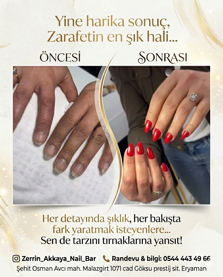 KALICI OJE KIZILAY 0543 462 45 11