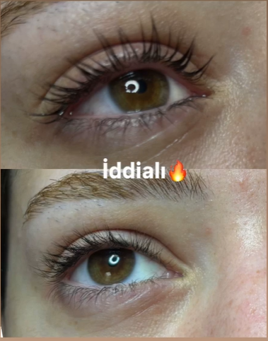  KİRPİK LİFTİNG KIZILAY  0 543 462 45 11