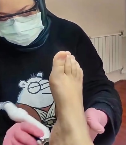 Ayak Sağlığı Merkezi Kızılay 0545 140 07 20