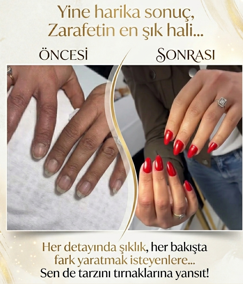 PROTEZ TIRNAK ÇANKAYA KIZILAY 0 543 462 45 11